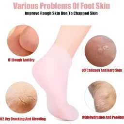 1 Pairs Silicone Socks for Women, Moisturizing Spa Socks, Heel Socks for Dry Cracked Feet, Women Foot Moisturizer Socks for Softening Calluses Skin Malti Colour. image 1