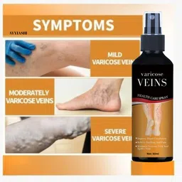 ayyiashi Varicose Veins Spray Effective Herbal Treatment For Vein Care Liquid image 3