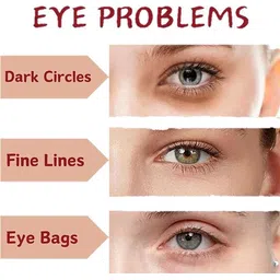 nirvikalpa ayurveda Bye Bye Dark Circles & Puffiness | Eye Cream for Men & Woenn-picture-24