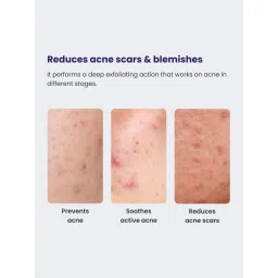 Re'equil 0.5% Retinol Night Cream - 30 gm image 2