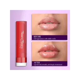TEEN TEEN COSMETICS Long Lasting Lip Balm-4 g- Strawberry image 4